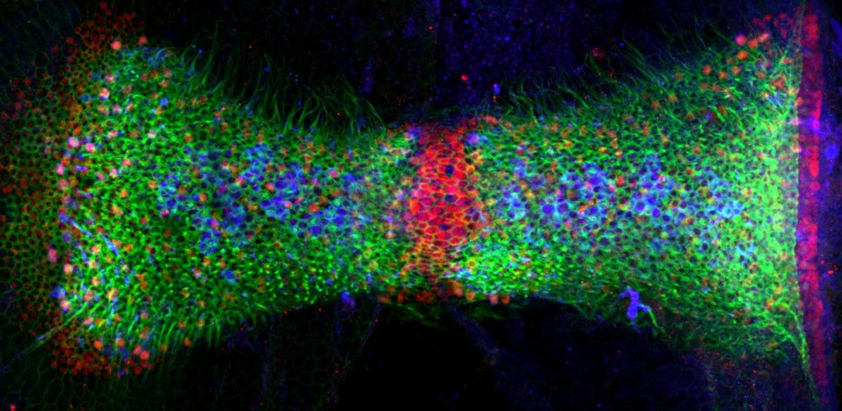 Researchers Aim to Regenerate Inner Ear Cells Key for Balance | ISCRM